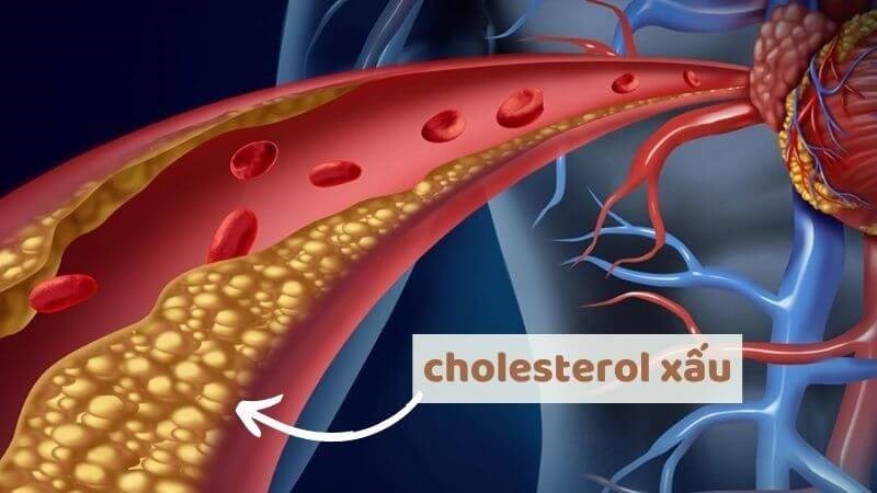 Cỏ lúa mạch giúp giảm cholesterol trong máu