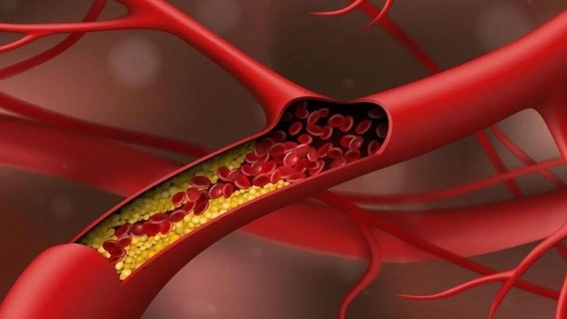 Việt quất có khả năng làm giảm quá trình oxy hóa của cholesterol xấu trong cơ thể
