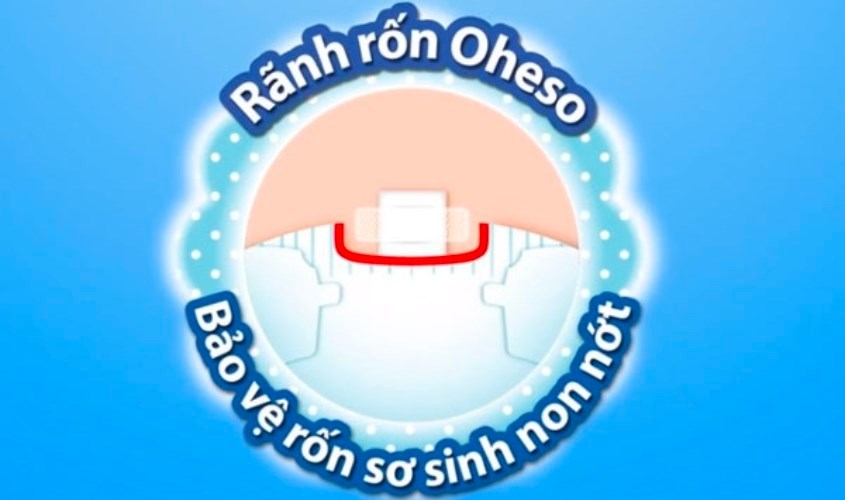 Có rãnh rốn Oheso tinh tế