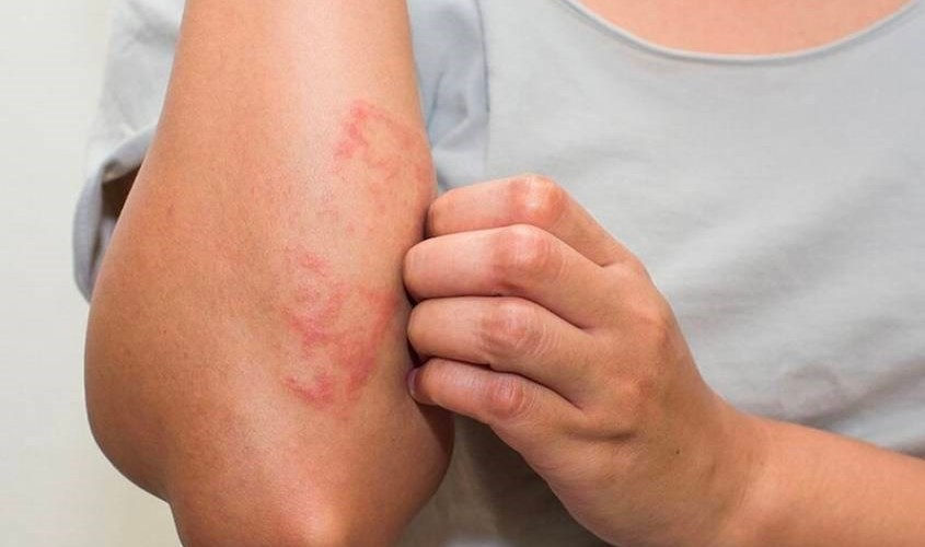 Điều trị các bệnh lý về da Điều trị các bệnh lý về da