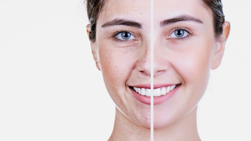 Quả táo gai giúp ngừa lão hóa da sớm do tiếp xúc với ánh nắng mặt trời hoặc tia cực tím quá nhiều
