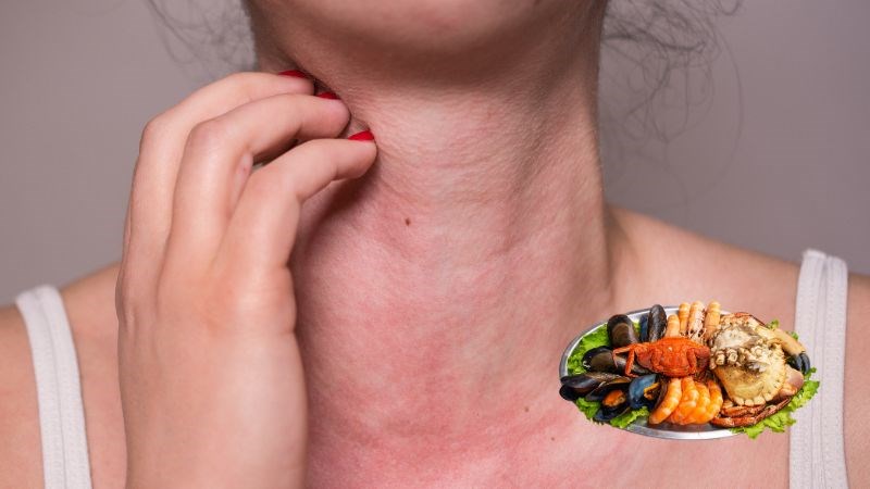 Tránh các thực phẩm gây dị ứng để tránh làm tăng tình trạng viêm xoang
