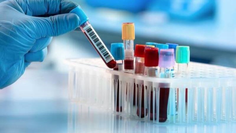 Xét nghiệm máu giúp phân biệt ung thư tuyến giáp với các bệnh lý khác