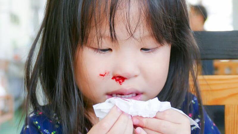 Trẻ em dưới 2 tuổi nên đến các cơ sở y tế khi chảy máu mũi