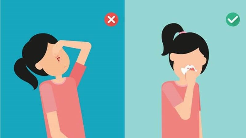 Thực hiện đúng những biện pháp sơ cứu để giảm tình trạng chảy máu cam