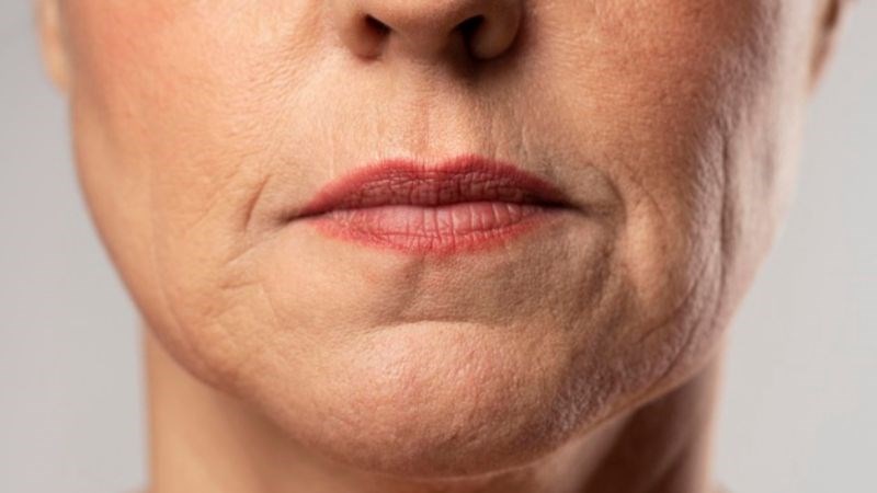 Vùng da cháy nắng thường có tốc độ lão hóa nhanh hơn