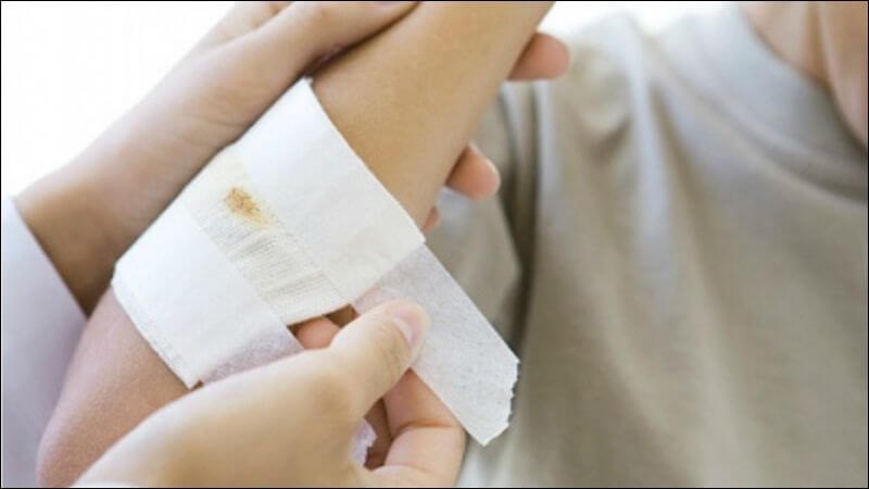 Hoạt chất trong rau má có khả năng kích thích sản xuất collagen giúp vết thương mau lành Hoạt chất trong rau má có khả năng kích thích sản xuất collagen giúp vết thương mau lành