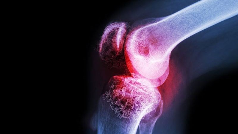 Đậu bắp chứa hàm lượng vitamin K đáng kể giúp ngăn ngừa loãng xương