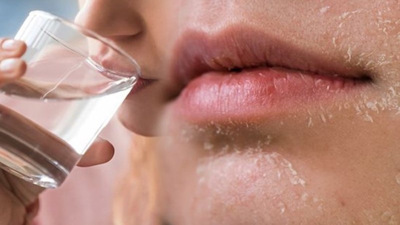 Uống nhiều nước sẽ giữ cho da được ngậm nước từ trong da ngoài