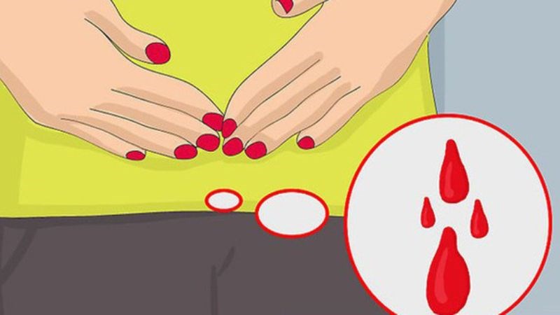 Mẹ bầu nên đi khám nếu tình trạng chảy máu kéo dài hơn 1 ngày Mẹ bầu nên đi khám nếu tình trạng chảy máu kéo dài hơn 1 ngày