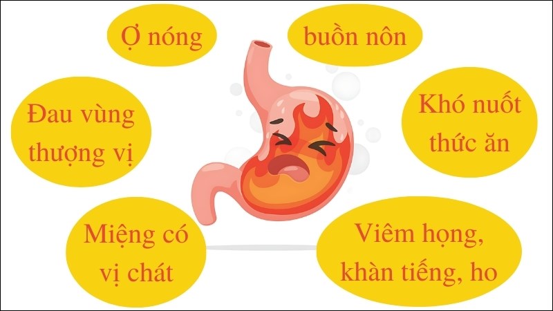 Các triệu chứng thường gặp ở người bị trào ngược dạ dày thực quản