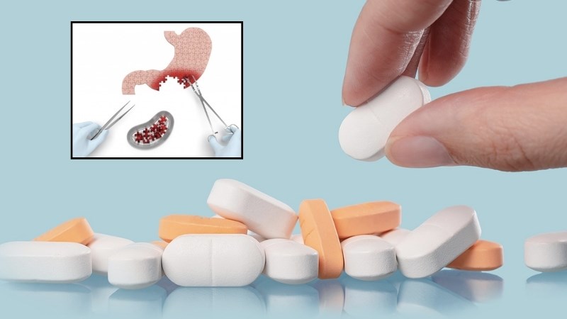 Bác sĩ chỉ định cho dùng thuốc để bảo vệ dạ dày hoặc phẫu thuật để cải thiện tình trạng bệnh tốt hơn