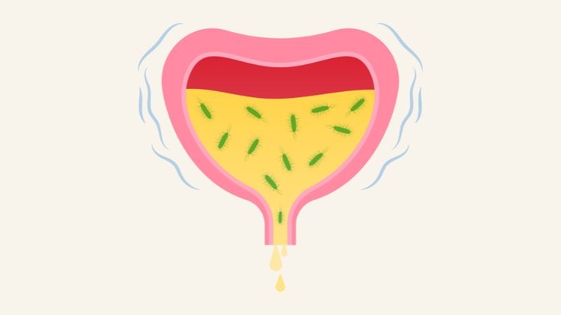 Đường tiết niệu của là nơi có thể bị tấn công bởi virus hoặc vi khuẩn 