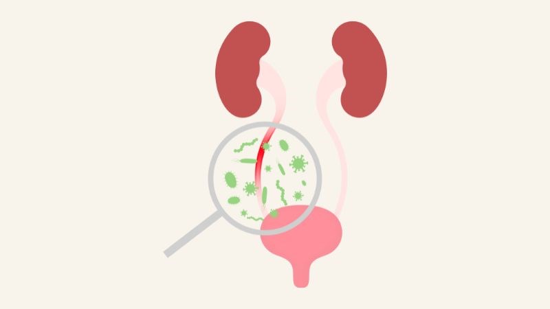 Viêm niệu đạo không do lậu là bệnh nhiễm trùng do các vi khuẩn khác gây ra