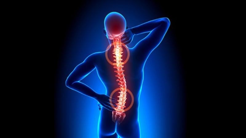 Bệnh viêm cột sống dính khớp có thể gây đau lưng