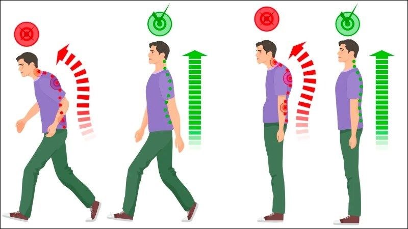 Tư thế không đúng là yếu tố nguy cơ cao dẫn tới đau lưng