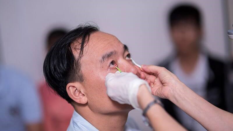 Thử nghiệm Schirmer giúp đánh giá khô mắt