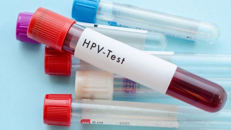 Xét nghiệm HPV DNA có thể phát hiện được virus gây bệnh trong cơ thể