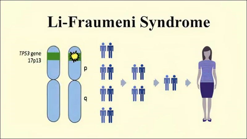 Hội chứng Li Fraumeni do rối loạn gen TP53