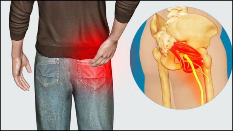 Bài thuốc chữa đau dây thần kinh hông từ kê huyết đằng
