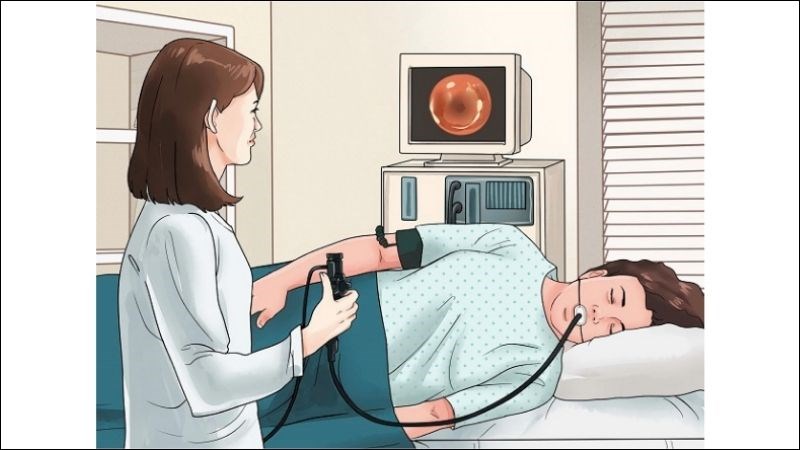 Nội soi dạ dày thường được thực hiện để chẩn đoán ung thư dạ dày