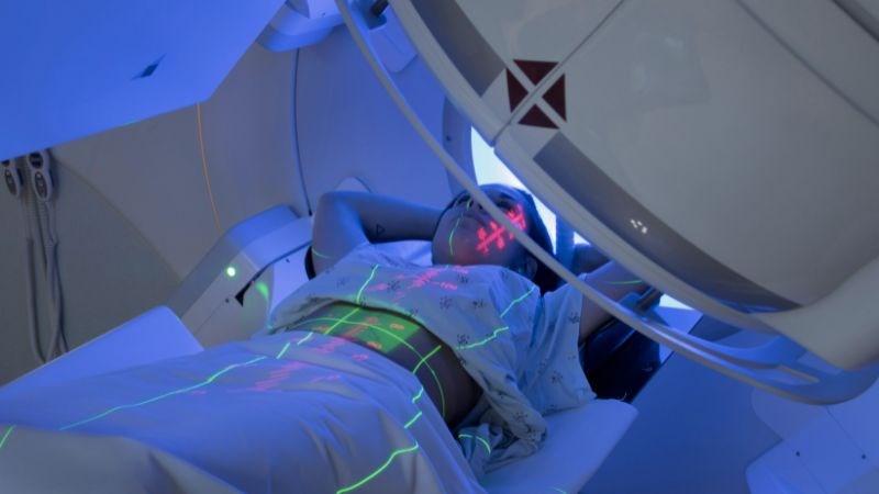 Xạ trị, một trong những phương pháp điều trị ung thư dạ dày