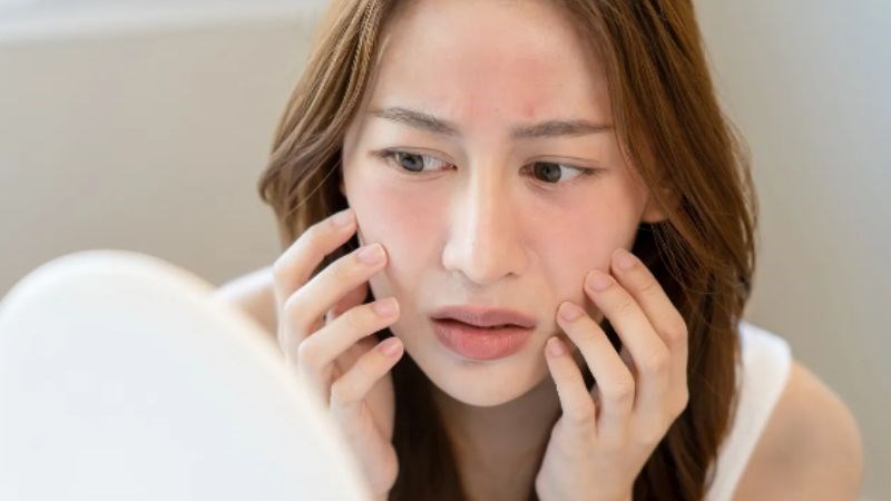 Da dễ kích ứng nên hạn chế sử dụng sản phẩm tẩy trang chứa nhiều hương liệu