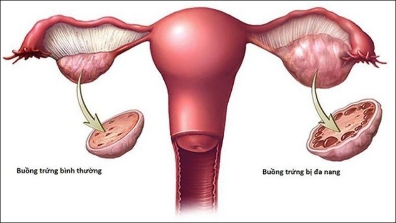 Máu Kinh Ra Ít Rồi Ngưng: Nguyên Nhân và Giải Pháp Cải Thiện Hiệu Quả