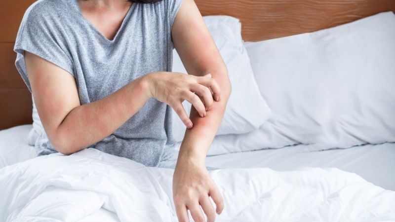 Khoai sọ có thể gây dị ứng nếu không được chế biến đúng cách