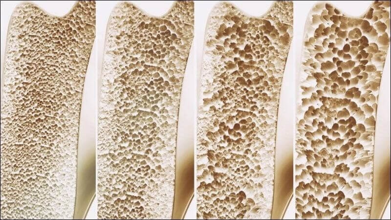 Ớt chuông cung cấp các nguyên tố vi lượng và vitamin, giúp ngăn ngừa loãng xương