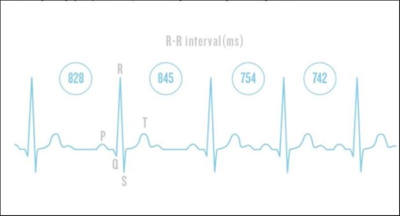 Đo HRV bằng phương pháp đo miền thời gian