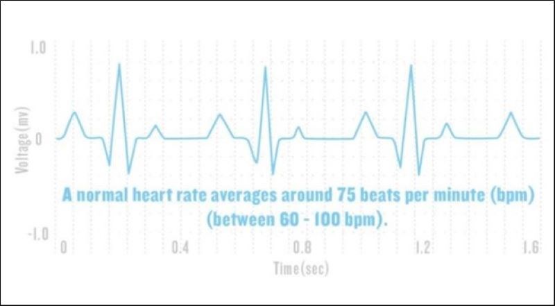 Đo HRV bằng phương pháp đo miền tần số