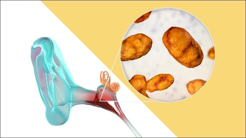 Nhỏ dịch chiết hoàng bá vào tai bị viêm của trẻ trong ngày giúp trị viêm tai giữa