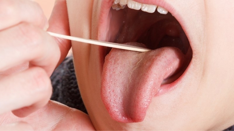 Bài thuốc kết hợp hoàng bá và trúc lịch giúp lưỡi của trẻ giảm viêm, sưng đau
