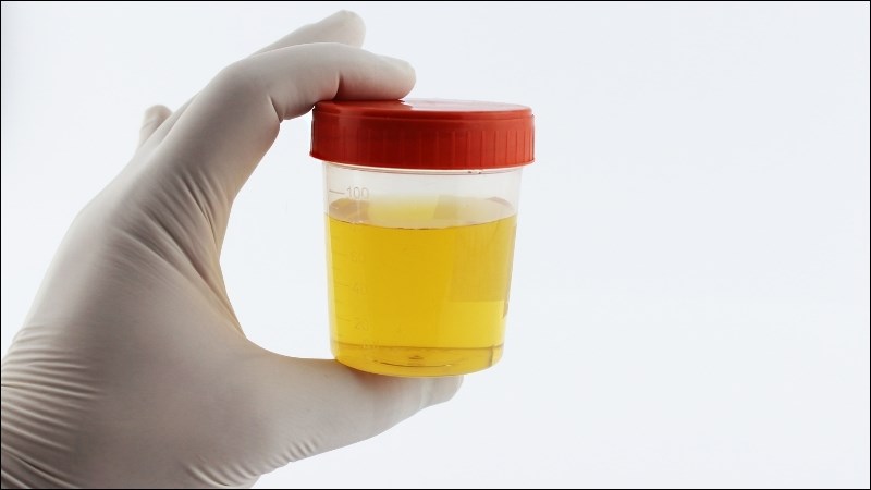 Dùng hoàng bá sao muối cùng với mộc nhĩ và trạch tả có thể trị chứng tiểu đục