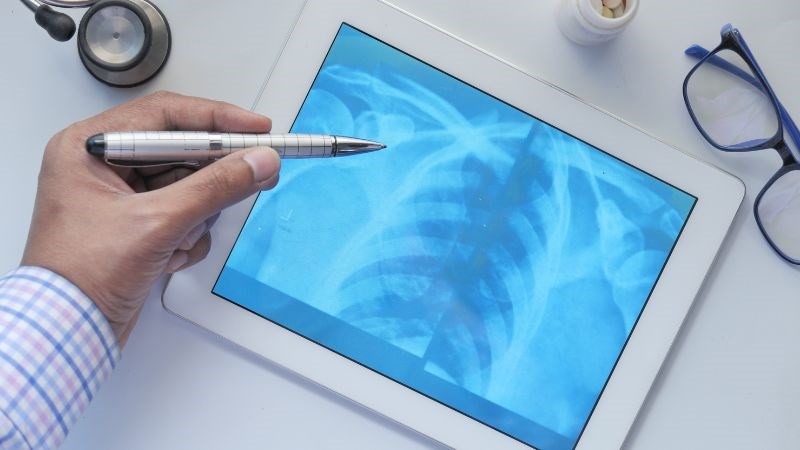 Bác sĩ có thể yêu cầu thực hiện một số xét nghiệm cận lâm sàng như chụp X-quang