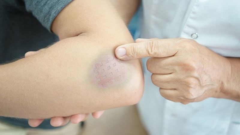 Tô mộc điều trị ngã chấn thương tụ máu