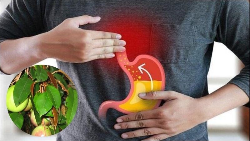 L&aacute; v&uacute; sữa c&oacute; thể hỗ trợ cải thiện bệnh tr&agrave;o ngược dạ d&agrave;y