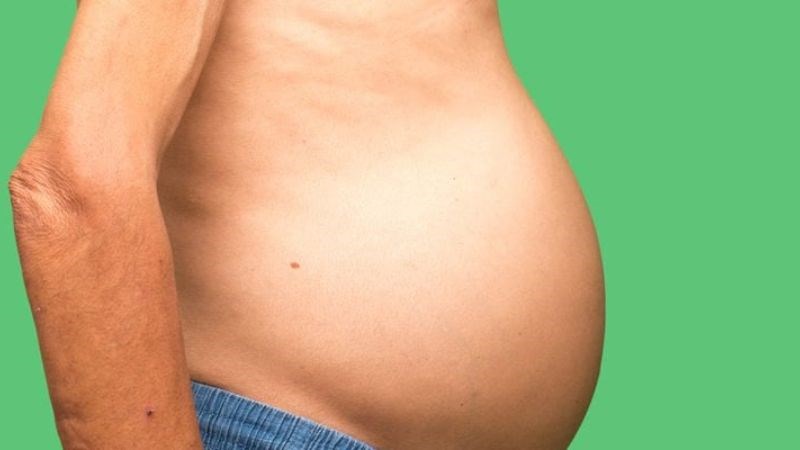 Xơ gan làm xuất hiện cổ trướng