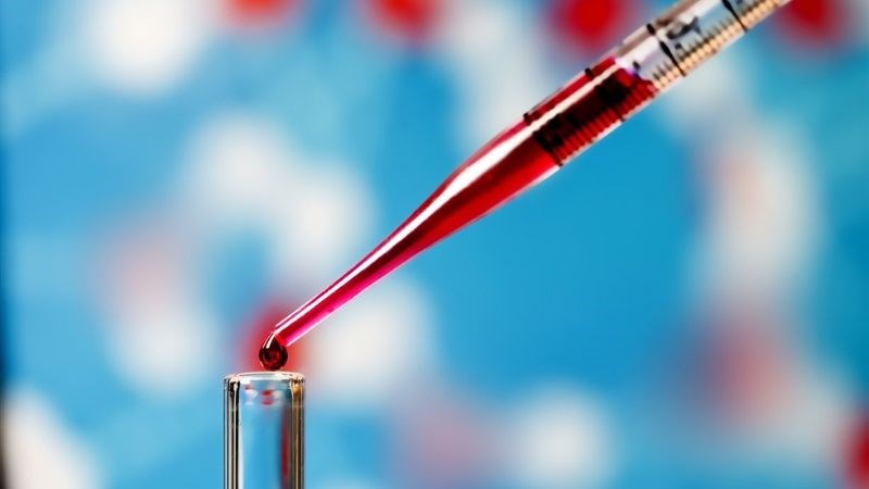 Xét nghiệm máu giúp chẩn đoán các vấn đề của suy tim Xét nghiệm máu giúp chẩn đoán các vấn đề của suy tim