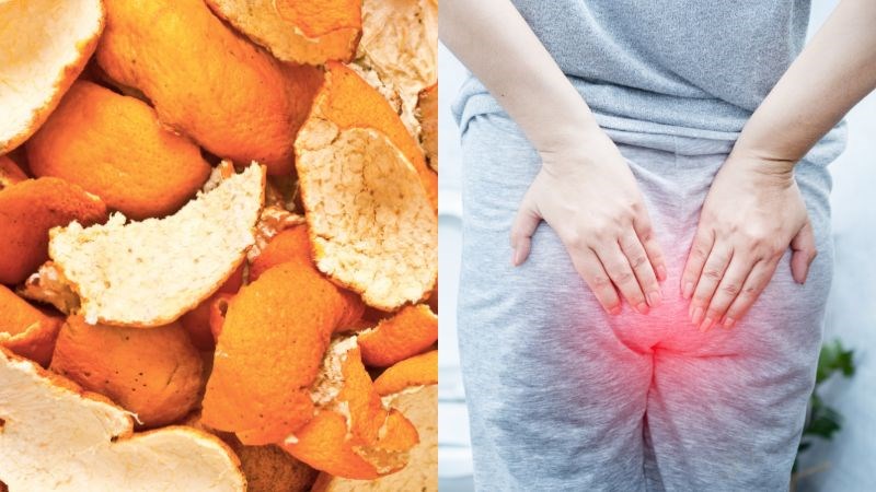 Bài thuốc trần bì trị trĩ chảy máu