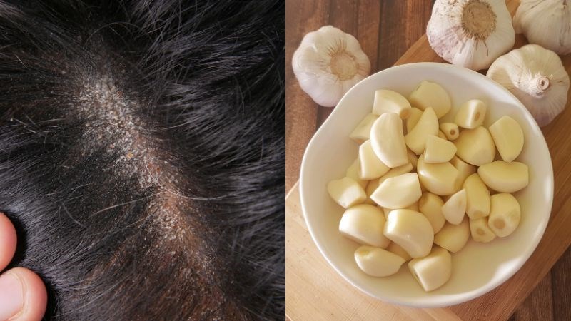 Allicin trong tỏi có khả năng tiêu diệt tế bào nấm