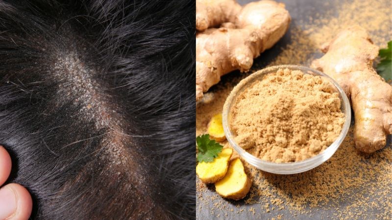 Gừng chứa gingerol là một hợp chất có đặc tính chống viêm mạnh