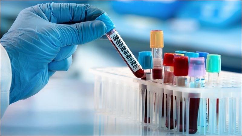 Nồng độ cồn trong máu (BAC) là tỷ lệ phần trăm cồn có trong máu