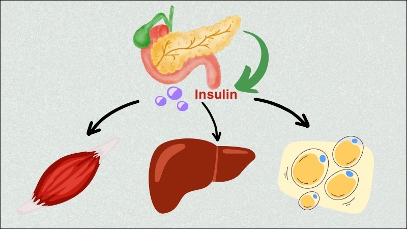 Sự đề kháng insulin ở các tế bào cơ, gan và mỡ gây ra bệnh tiểu đường type 2