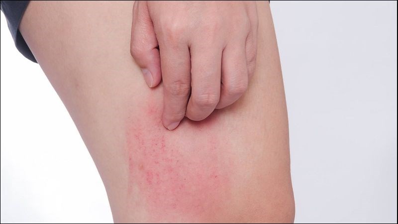 Ung thư gan có thể gây ngứa da