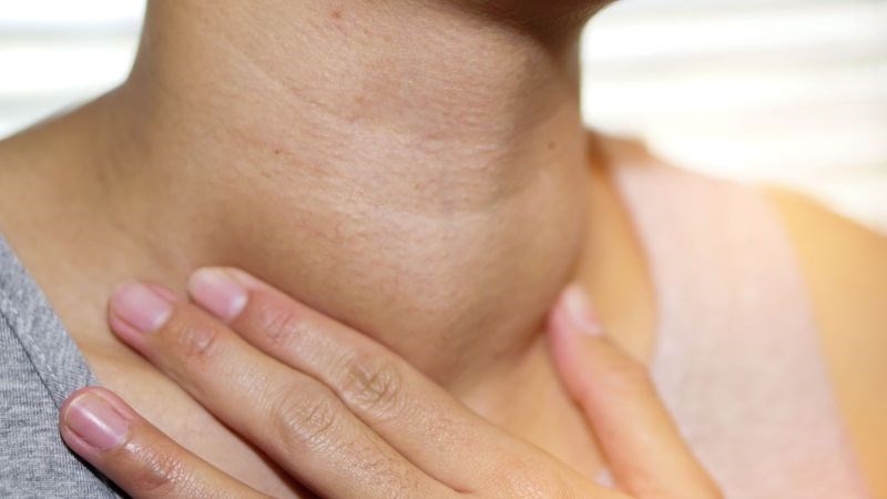 U tuyến giáp thường được phát hiện khi kích thước khối u lớn