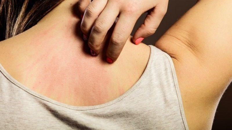 Bệnh về gan gây ngứa da kéo dài