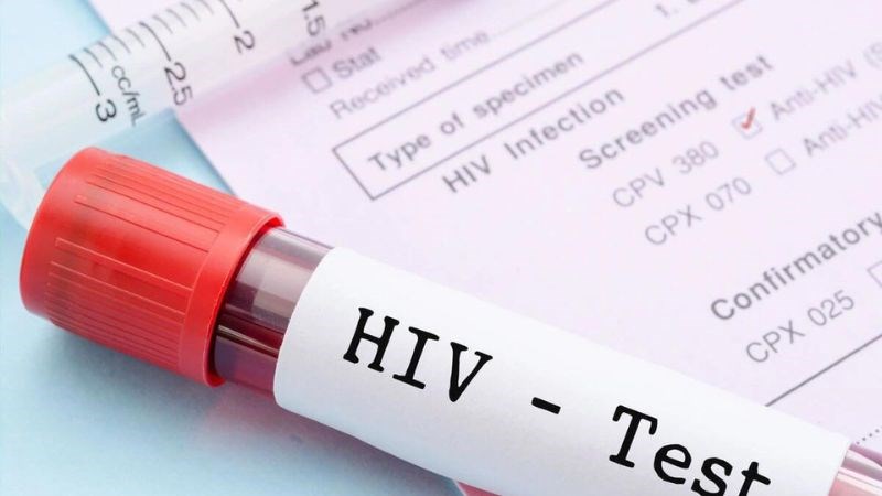 Xét nghiệm chẩn đoán HIV nên thực hiện sau phơi nhiễm 4 - 6 tuần