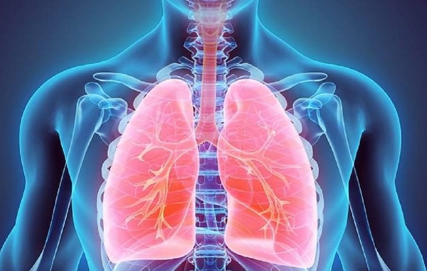 Viêm khí phế quản cấp là một bệnh nhiễm trùng đường hô hấp vào mùa đông xuân